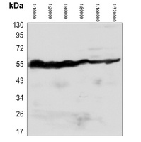 Beta-tubulin Antibody-HRP labled