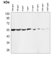 Beta-tubulin Antibody-HRP labled