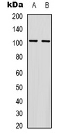 GLUR4 Rabbit Polyclonal Antibody