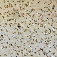 GLUR4 Rabbit Polyclonal Antibody
