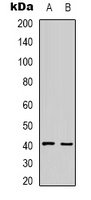 HAO1 Rabbit Polyclonal Antibody