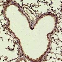 HAO1 Rabbit Polyclonal Antibody