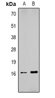 Histone H1 (DiMethyl-K25) Rabbit Polyclonal Antibody