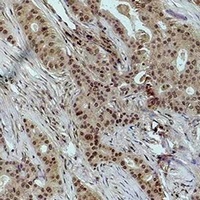Histone H1 (DiMethyl-K25) Rabbit Polyclonal Antibody