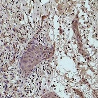Histone H1 (MonoMethyl-K25) Rabbit Polyclonal Antibody