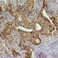 Histone H1 (Phospho-T17) Rabbit Polyclonal Antibody