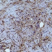 Histone H1 (Phospho-T4) Rabbit Polyclonal Antibody