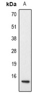 Histone H2A (Acetyl-K9) Rabbit Polyclonal Antibody