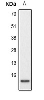 Histone H2A (Phospho-S129) Rabbit Polyclonal Antibody