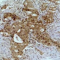 Histone H2A.X (Phospho-S139) Rabbit Polyclonal Antibody