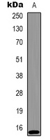 Histone H2A.X (Phospho-T120) Rabbit Polyclonal Antibody