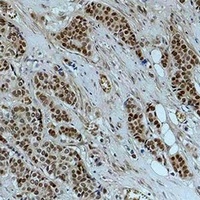 Histone H2B (Acetyl-K20) Rabbit Polyclonal Antibody