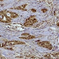 Histone H2B (Phospho-S14) Rabbit Polyclonal Antibody