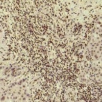 Histone H3 (Acetyl-K14) Antibody