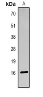 Histone H3 (Acetyl-K18) Antibody