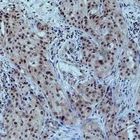 Histone H3 (Acetyl-K23) Antibody