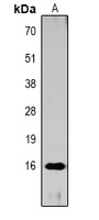 Histone H3 (Acetyl-K27) Antibody
