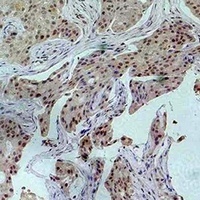 Histone H3 (Acetyl-K27) Antibody