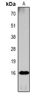 Histone H3 (Acetyl-K36) Antibody