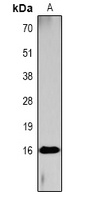 Histone H3 (Acetyl-K4) Antibody
