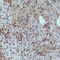 Histone H3 (Acetyl-K4) Antibody