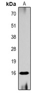 Histone H3 (Acetyl-K56) Antibody
