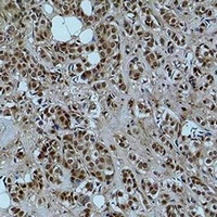 Histone H3 (Acetyl-K56) Antibody