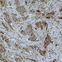 Histone H3 (Acetyl-K79) Rabbit Polyclonal Antibody