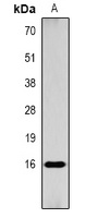 Histone H3 (Acetyl-K9) Antibody
