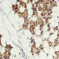 Histone H3 (Citruline-R2+R8+R17) Rabbit Polyclonal Antibody