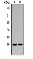 Histone H3 (DiMethyl-K27) Antibody