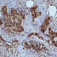 Histone H3 (DiMethyl-K27) Antibody