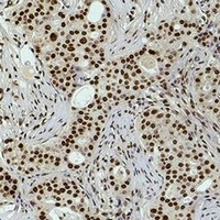 Histone H3 (DiMethyl-K36) Antibody