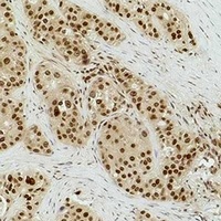 Histone H3 (DiMethyl-K9) Antibody