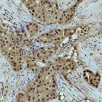 Histone H3 (MonoMethyl-K18) Antibody