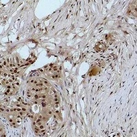 Histone H3 (MonoMethyl-K4) Antibody