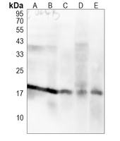 Histone H3 (MonoMethyl-R2) Rabbit Polyclonal Antibody
