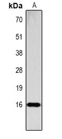 Histone H3 (Phospho-S28) Rabbit Polyclonal Antibody