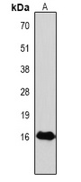 Histone H3 (Phospho-T118) Antibody