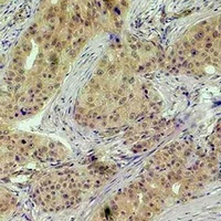 Histone H3 (Phospho-T118) Antibody