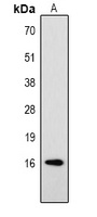 Histone H3 (Phospho-T32) Antibody