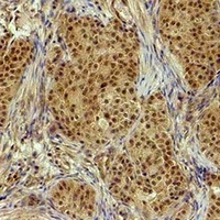 Histone H3 (Phospho-T32) Antibody