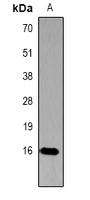 Histone H3 (Phospho-T45) Antibody