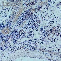 Histone H3 (Phospho-T45) Antibody