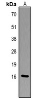 Histone H3 (Phospho-T6) Antibody