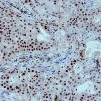 Histone H3 (Phospho-T6) Antibody