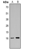 Histone H3 (TriMethyl-K14) Antibody