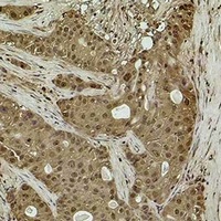 Histone H3 (TriMethyl-K14) Antibody