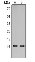 Histone H3 (TriMethyl-K18) Antibody
