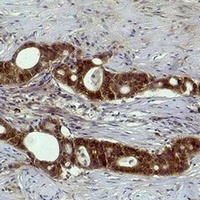 Histone H3 (TriMethyl-K27) Antibody